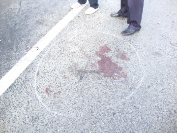 Vârstnic, accidentat de un autoturism